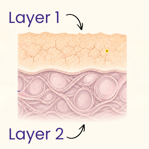 Two-layer skin diagram